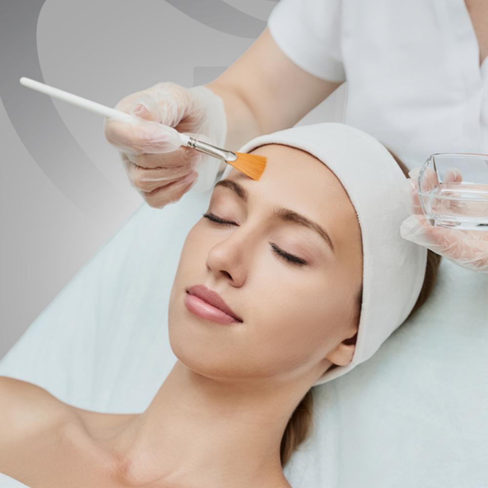 تقشير كيميائي