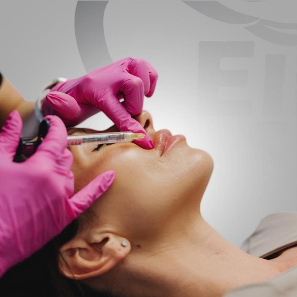 فيلر الشفايف